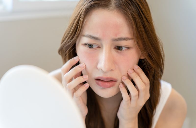 Cách nhận biết mụn đã chín